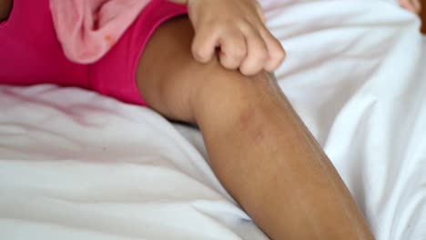 Child-girl-suffering-from-itching-skin,-close-up