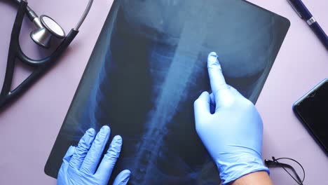 Doctor-hold-analyzing-xray-photography-closeup