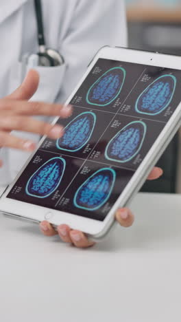 Person,-hands-and-doctor-on-tablet-with-brain-scan