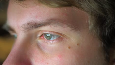 Mann-Blickt-Mit-Tränensäcken-Unter-Den-Augen-Auf-Den-Computerbildschirm