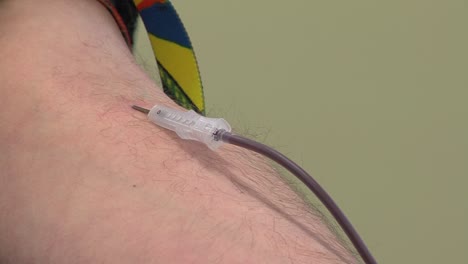 Close-up-of-a-needle-during-blood-drawing
