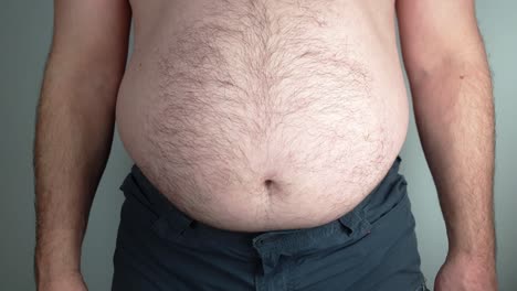 An-overweight-man-cannot-hold-in-his-stomach-anymore