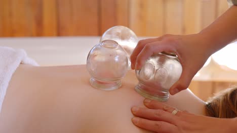physiotherapist-performing-cupping-therapy-on-the-back-of-a-patient,-the-therapist-is-removing-a-suction-cup