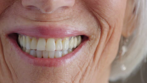 Closeup-teeth-of-a-senior-woman-with-wrinkles
