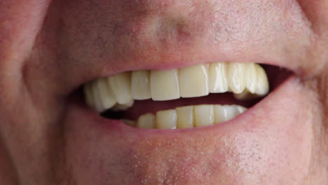 Nahaufnahme-Eines-Lachenden-Mannes,-Der-Zähne-Zeigt