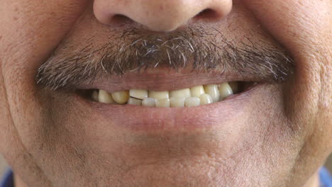 Mann-Mit-Ungleichmäßigen,-Gelben-Zähnen-Lächelt