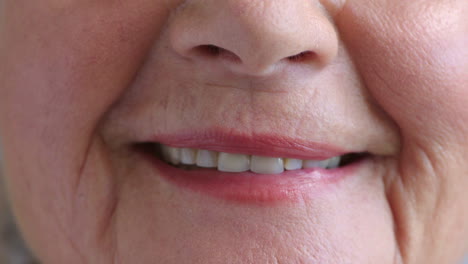 Eine-ältere-Frau-Mit-Zahnproblemen