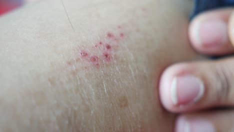 Young-women-suffering-from-itching-skin