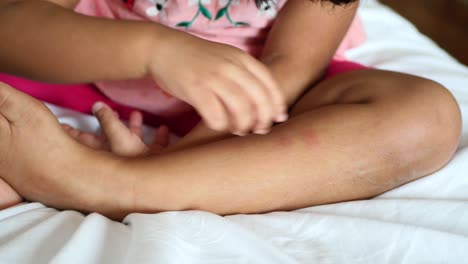 Child-girl-suffering-from-itching-skin,-close-up